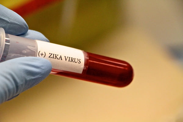 Vacina brasileira contra o zika apresenta resultados promissores