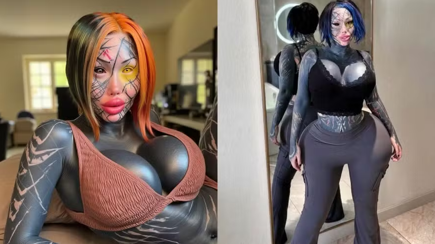 FireShot Capture 543 - Modelo canadense que gastou R$ 2,6 milhões em cirurgias e tatuagens_ - [oglobo.globo.com].png