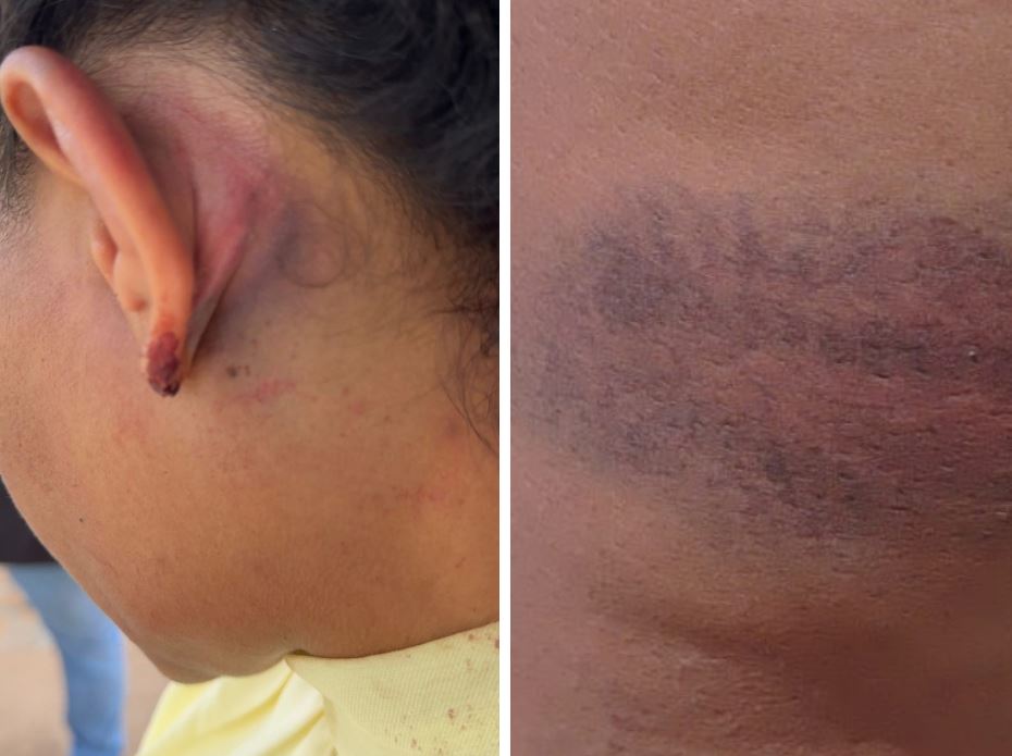 Fotos: Jornalismo TCM