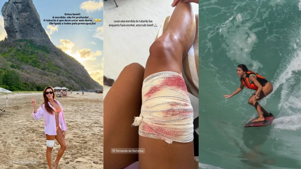 A advogada Tayane Cachoeira Dalazen, de 36 anos, foi mordida por um tubarão-lixa durante um mergulho em Fernando de Noronha (PE), realizado na última sexta-feira (9).  • Reprodução/Redes Sociais