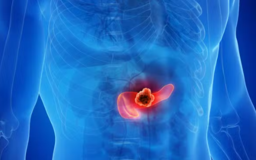 FireShot Capture 047 - Cientistas eliminam câncer de pâncreas em testes com animais - G1_ - [g1.globo.com].png