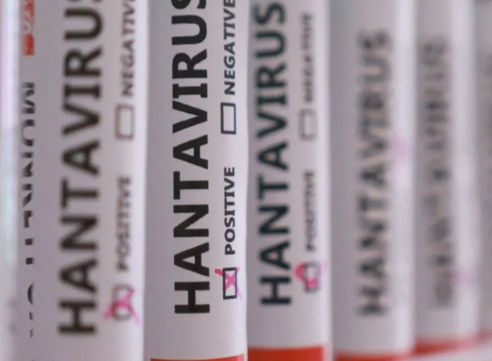 HANTAVIRUS.PNG